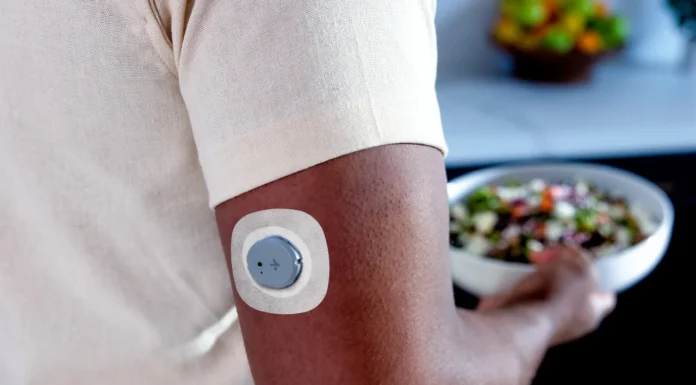 Life Time Fitness teamar upp med Dexcom Dexcom Stelo