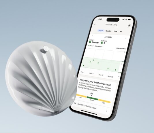 Withings lanserar U-Scan – världens första smarta toalettlabb för hemmabruk Withings U Scan App