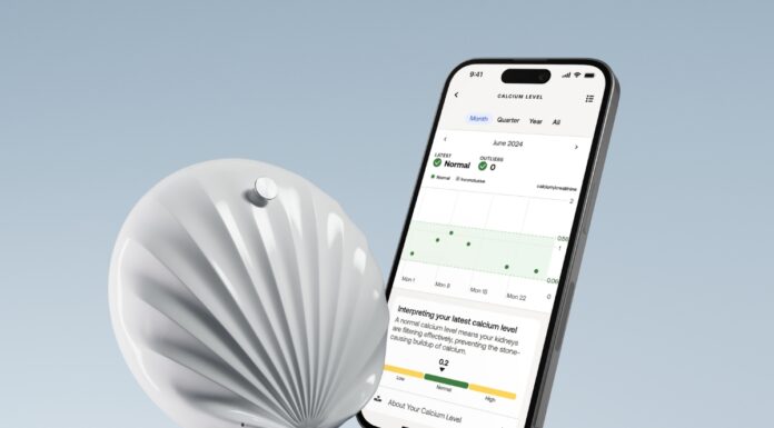 Withings lanserar U-Scan – världens första smarta toalettlabb för hemmabruk Withings U Scan App